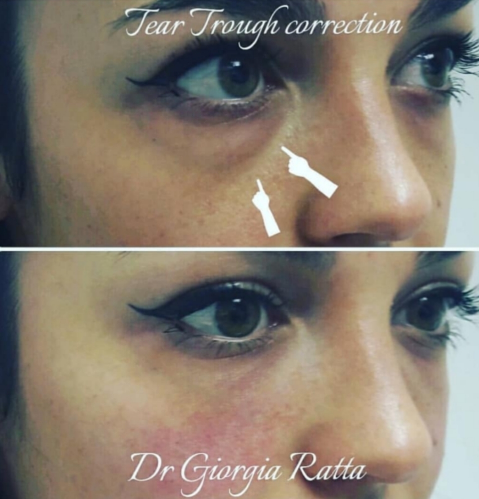 Dr Giorgia Ratta - before and after treatment image