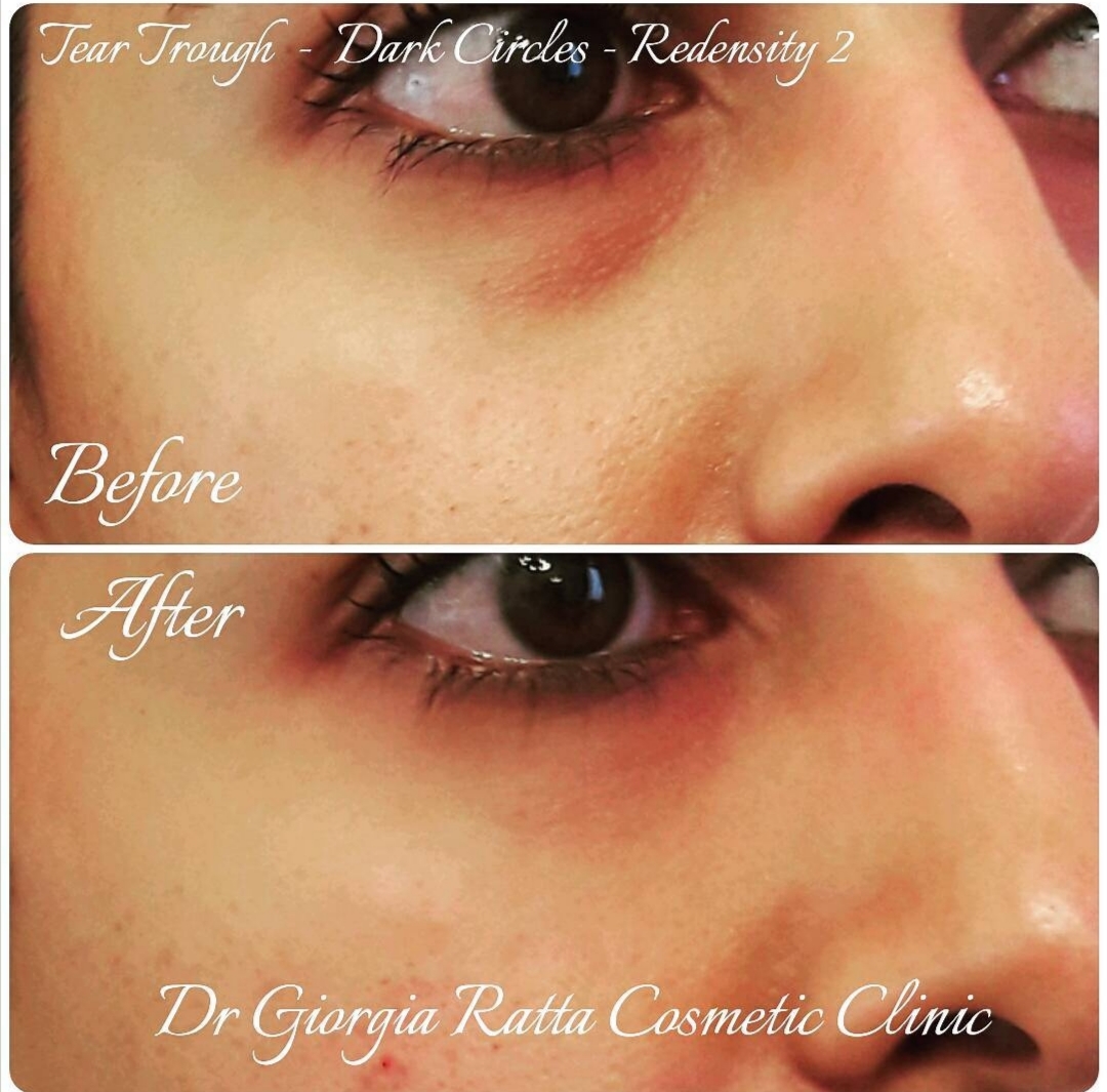 Dr Giorgia Ratta - before and after treatment image