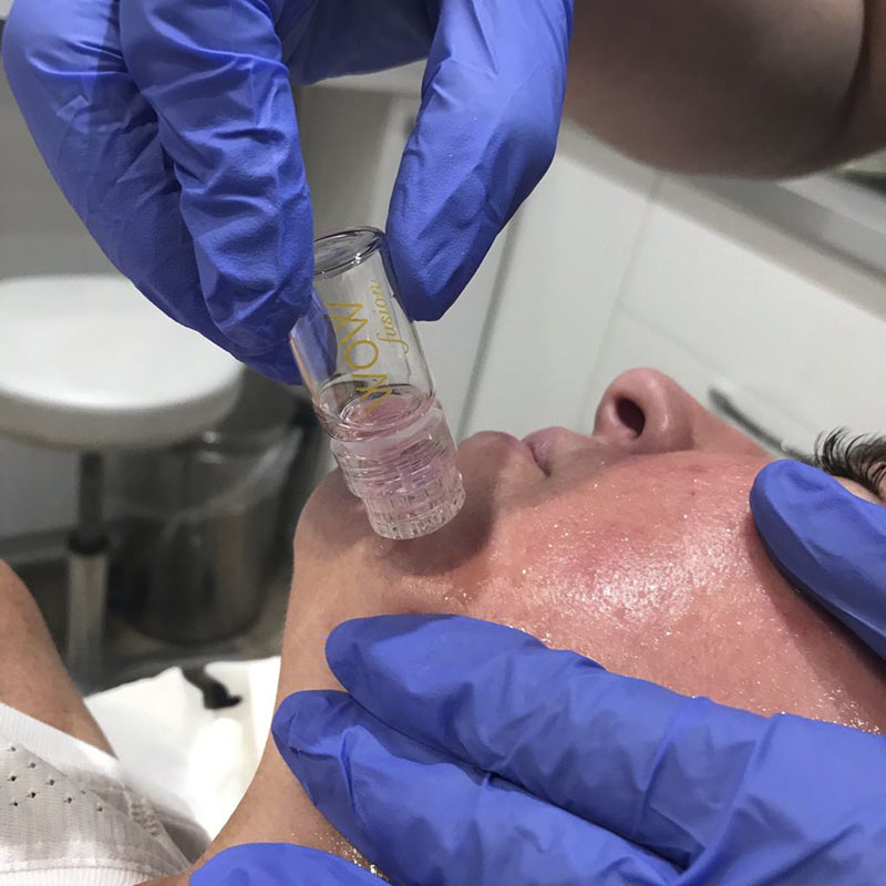 Dr Giorgia Ratta performing a WOW Fusion medical grade facial treatment